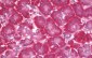PFDN5 / MM1 Antibody